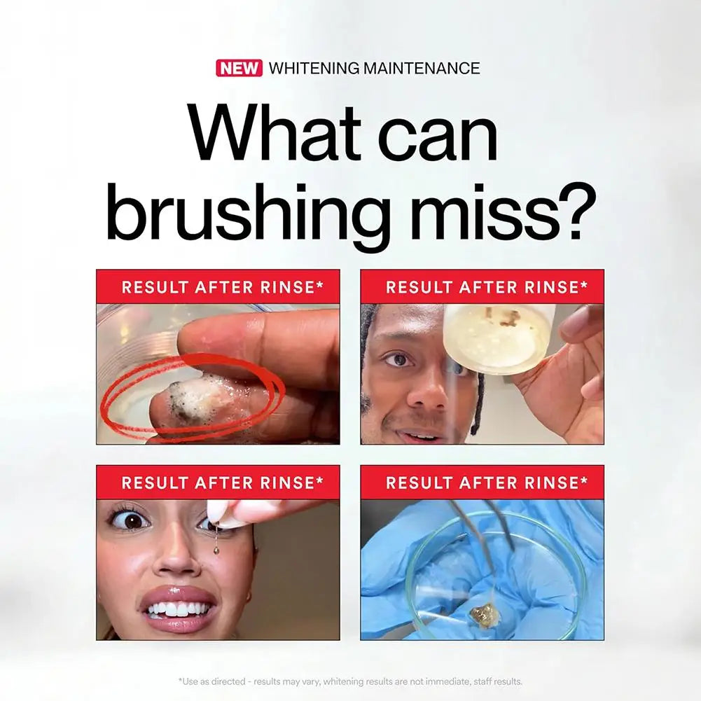 Hismile ID Whitening Stain Mouthwash 237ml β Long-Lasting Fresh Breath, Removes Stains & Plaque, Brightens Teeth, Oral Care